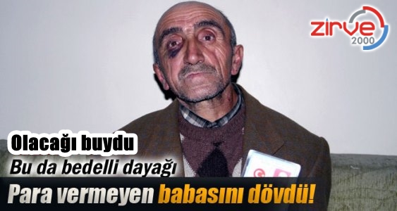 Ellerin kırılsın