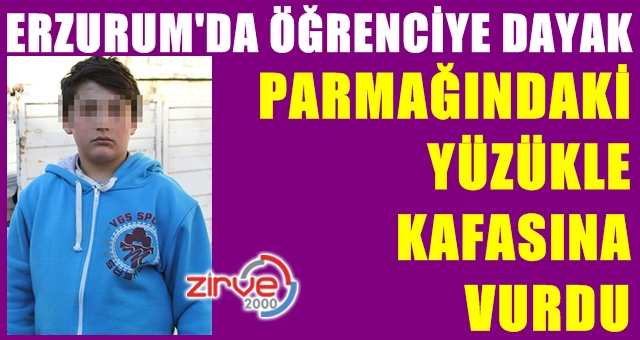 Sakız yüzünden dayak yedi