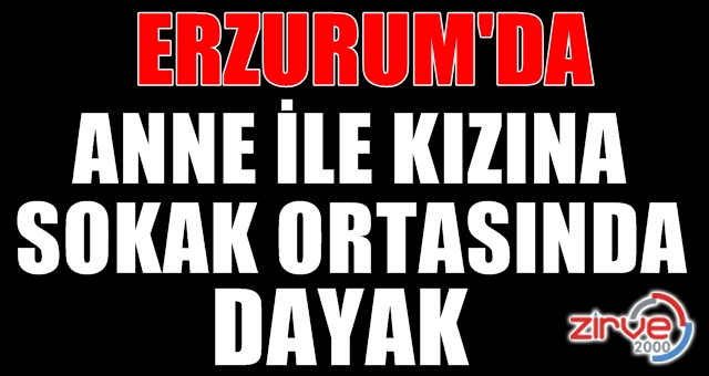 Bıçakla saldırdılar