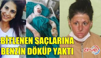 ESTETİK İÇİN YARDIM BEKLİYOR