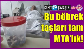 Bu böbrek taşları tam MTA’lık!
