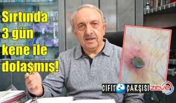 Sırtında 3 gün kene ile dolaşmış!
