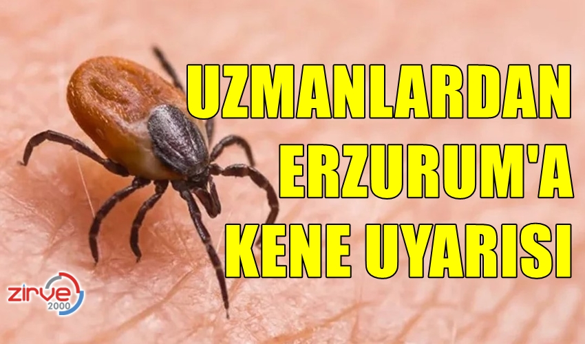 ERZURUM İÇİN KENE UYARISI